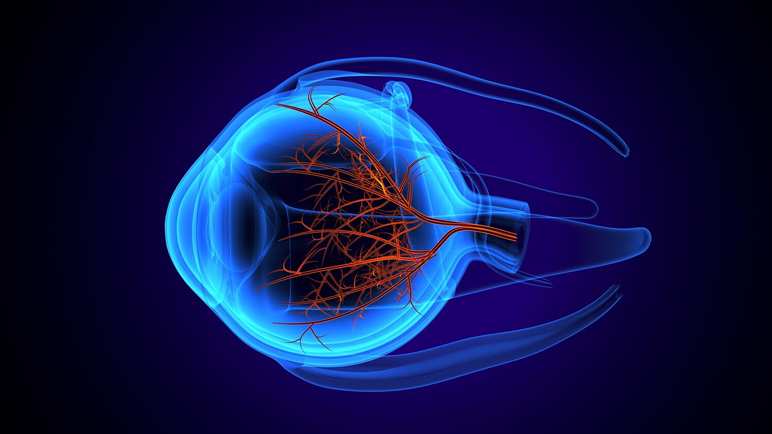 glp 1 optic nerve Optic Nerve Stroke and NAION Linked to GLP-1 Medications